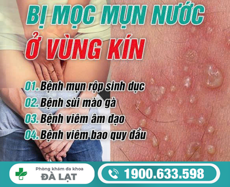 Hình ảnh minh họa